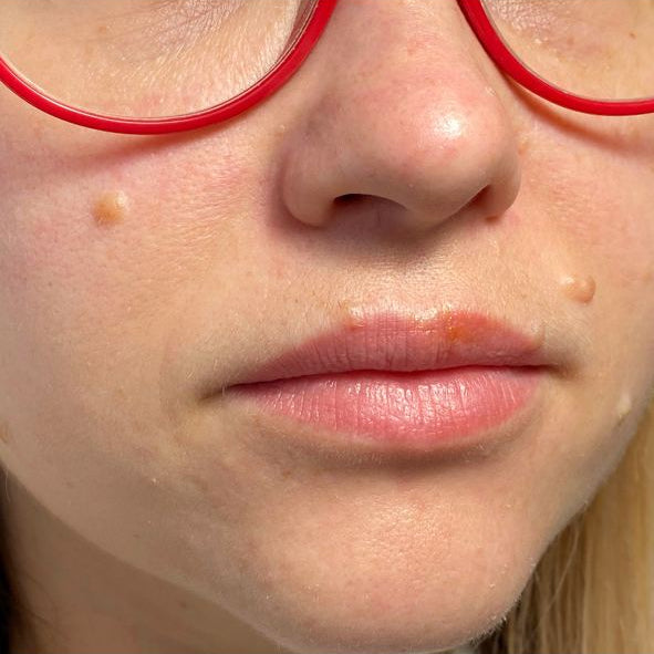 Genezen lip blush met een mix van FACE Chili en Caramel