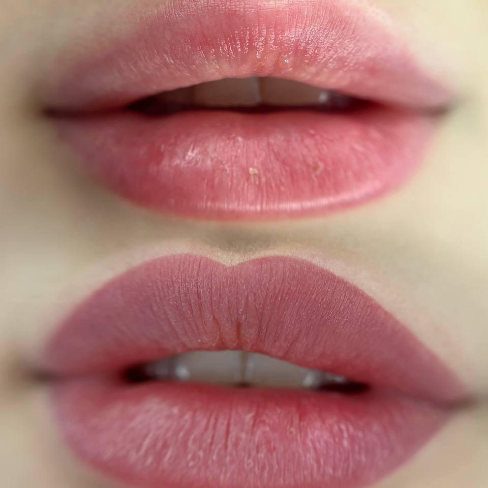 Verheilte Lippen mit FACE Lilac pur