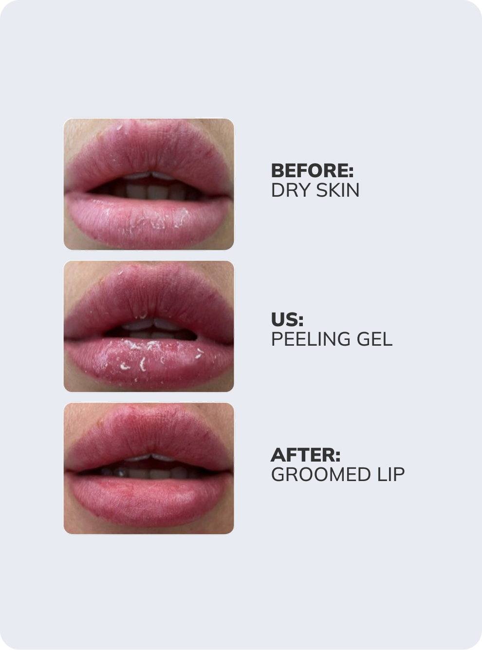 AS Company Peeling Gel Active Oxygen for PMU skin care, product detail