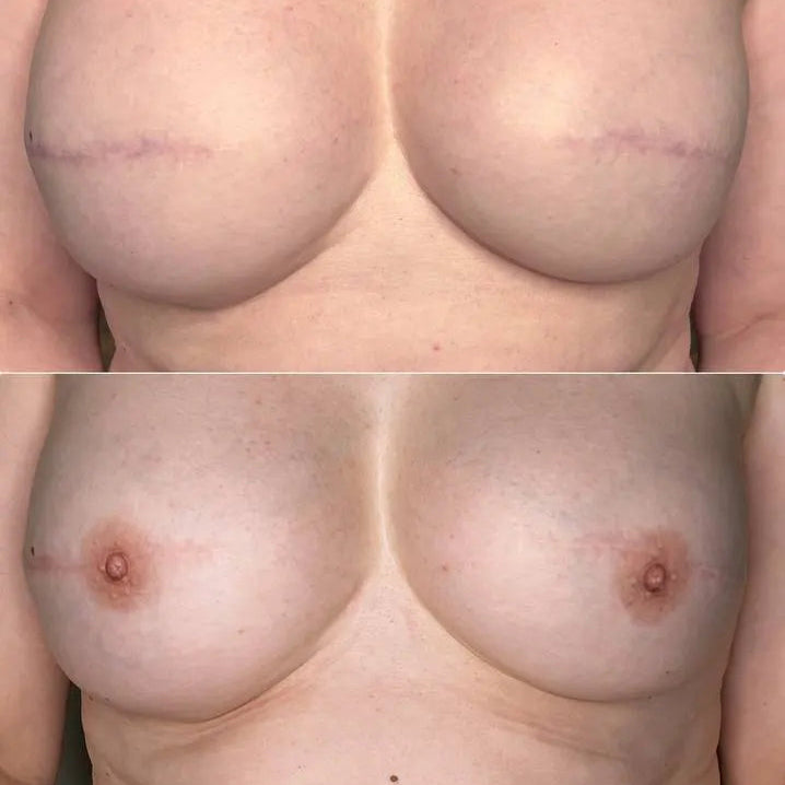 Hanafy areola pigments for areola permanent makeup, PRO line