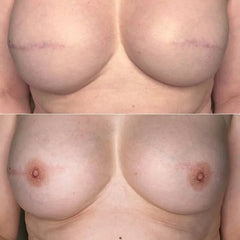 Hanafy Areola PRO Set by Pavel Somov – Professionele Pigmenten voor Tepelhofreconstructie (3 tinten) hover