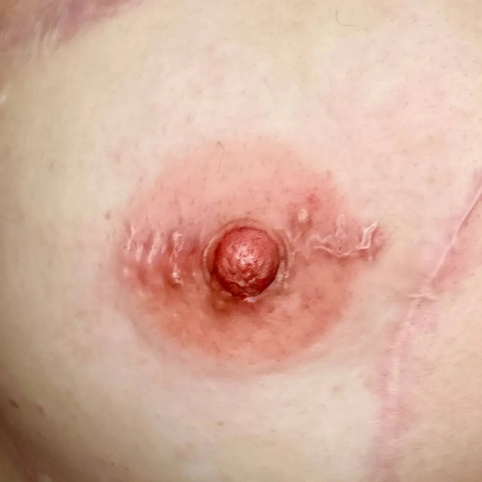 Hanafy Areola PRO Set by Pavel Somov – Professionele Pigmenten voor Tepelhofreconstructie (3 tinten)