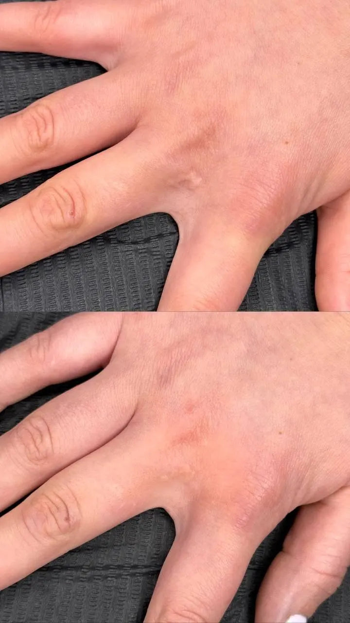 hanafy camouflage pigments healed