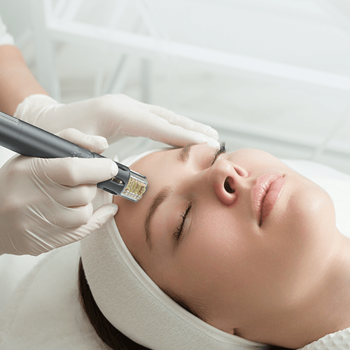 Microneedling treatment with the Uhooma M20 pen and cartridge